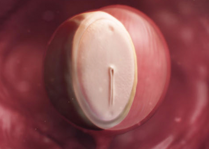 胚のリアルな絵｜不妊治療HP