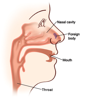 子供の鼻の構造｜不妊治療HP